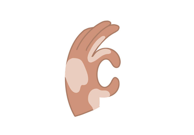 drcheena® Vitiligo Treatment Starter Pack